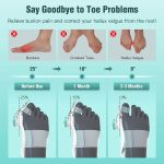 آتل انگشت شست پا تنیکور Tenicore MX3Q bunion corrector with anti-slip heel strap - Image 3