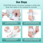 آتل انگشت شست پا تنیکور Tenicore MX3Q bunion corrector with anti-slip heel strap - Image 6